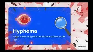 Miniature : Du Sang Dans l’Œil : Une Urgence à Ne Jamais Ignorer