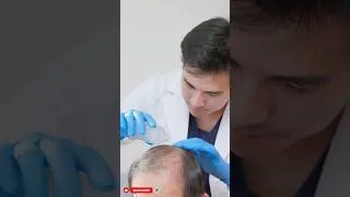 Miniature : Perte de cheveux  quand faut il vraiment s'inquiéter ? #Santé #Cheveux #Prévention