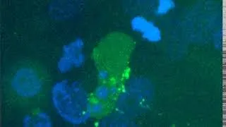 Miniature : Visualisation en temps réel de l’infection de la muqueuse génitale par le VIH