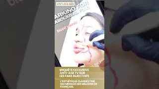 Miniature : Fake Injectors : l'esthétique clandestine qui menace des millions de Français | ANTI-AGE TV