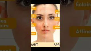 Miniature : Voulez-vous avoir une peau éclatante sans imperfections?? #fypシ゚viral #explore #skincare