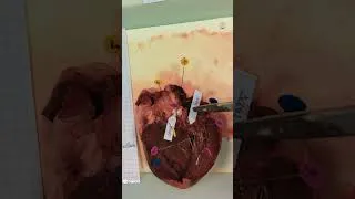 Miniature : Cœur disséqué - présentation rapide
