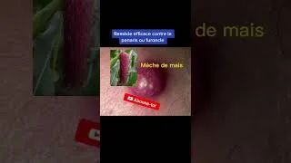 Miniature : Meilleures remède pour tué le PANARIS