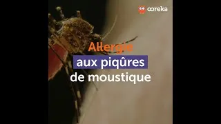 Miniature : Allergie aux piqûres de moustique : comment se soigner ?