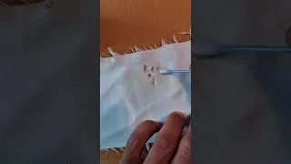 Miniature : Comment enlever du sang sur un tissu blanc?   #blood  #astucecouture #hack #couture #sang