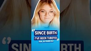 Miniature : Since birth, I’ve been nourished through a feeding tube that connects directly to my stomach.