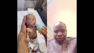 Miniature : Un joli bébé prend le biberon