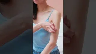 Miniature : Eczéma de Contact : Causes, Symptômes et Traitement en 60s ⚠️