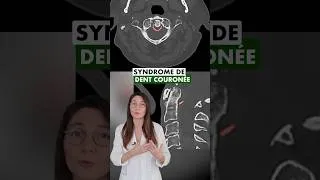 Miniature : 🦷👑 Syndrome de la dent couronnée : une cause de douleurs cervicales !