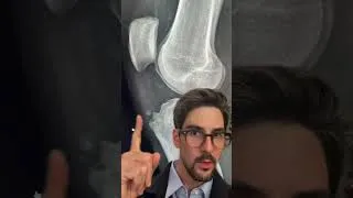 Miniature : Réponse cas clinique radiologie - Dr Antoine Kirchner #radiology