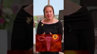 Miniature : La grossesse ectopique #grossesse #enceinte #ectopicpregnancy