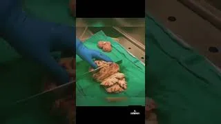 Miniature : 🧠 Dissection avec coupes anatomiques axiales