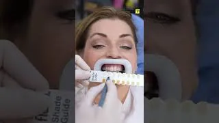 Miniature : ESKE W PA ANVI KONNEN KISA DANTIS YO FE POU BLANCHI DAN PASYAN YO ?