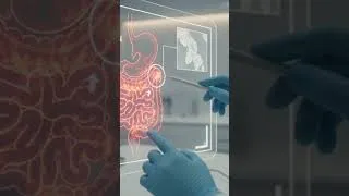 Miniature : Occlusion Intestinale  Les Signes d’Alerte qui Peuvent Sauver une Vie