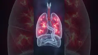 Miniature : L'intubation médicale  risques et secrets