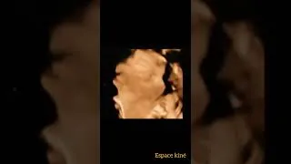 Miniature : #shorts#bruit_de_coeur_du_foetus#