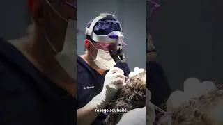 Miniature : Quel est le prix d'une greffe de cheveux dans une clinique Bordelaise ?