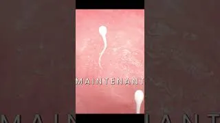 Miniature : Une course contre la montre microscopique ⏱️ #science #biologie #shorts