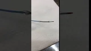 Miniature : Angioplastie - Angioplasty