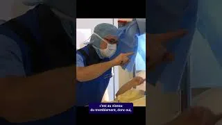 Miniature : Opérer le cerveau sans endormir le patient : comment est-ce possible ?