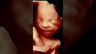 Miniature : Fetal Sensations at 22 Weeks: Babies can  Feel in the Womb #baby #babydevlopment #babygirl #babyboy