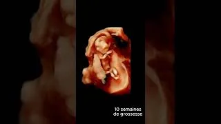 Miniature : 3D Journey: Discover a 10-Week-Old Fetus #3d #embryology #pregnancy #sonography