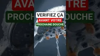 Miniature : Ce qui vit dans votre douche va vous surprendre !