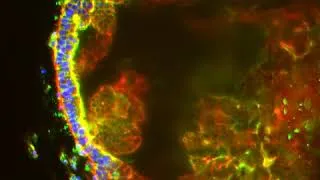 Miniature : Institut Imagine - Microscope à feuille de lumière - Plateforme IPS