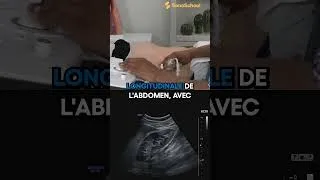 Miniature : Reins : le balayage clé de l'abdomen supérieur | iSonicSchool