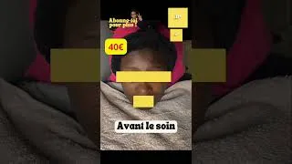 Miniature : Tes taches refusent de partir mm avec une routine skincare parfaite ??? #skincare