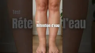 Miniature : Comment savoir si tu fais de la rétention d’eau💦 ?