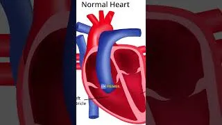 Miniature : AS-TU UN COEUR D’ATHLÈTE ? ❤️