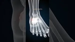 Miniature : #épinecalcalienne #shortvideo #youtubeshorts #anatomie #pied