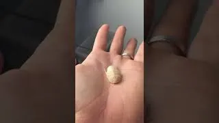Miniature : Sais tu pourquoi cette blatte est blanche ?? 😉