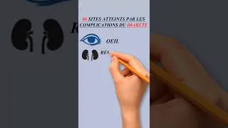 Miniature : 06 Sites atteints par les complications du diabète. #diabete