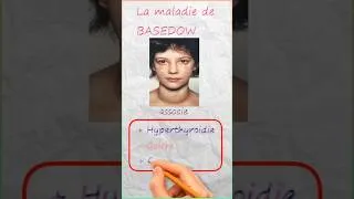 Miniature : La Maladie de BASEDOW.