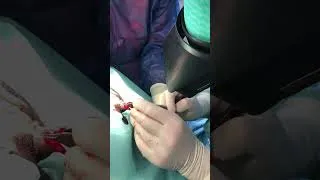 Miniature : dissection os penien