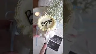 Miniature : It’s a girl 💕 #babygirl #baby #grossesse