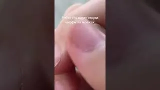 Miniature : 🦟arme biologique rêvée de bill gate où puceron commun