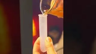 Miniature : L'urine humaine au microscope