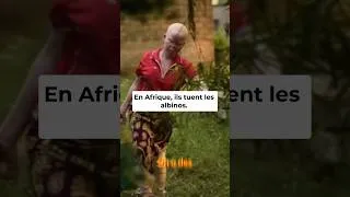 Miniature : vivre avec les albinos en Afrique : Témoignages poignants