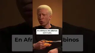 Miniature : Albinos - La Peur et la Violence en Afrique