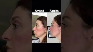Miniature : 20 août 2026