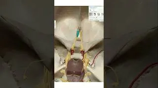 Miniature : Tous les foramens de la base du crane (prt 1) #anatomy #medecine #science #anatomie #crane #doctor