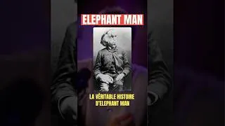 Miniature : La folle histoire d'Elephant Man