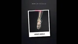 Miniature : Xpert Ankle - Ankle trauma plates