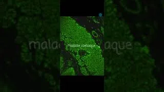 Miniature : la maladie coeliaque