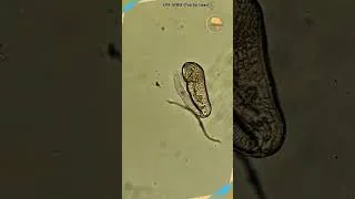 Miniature : Qu’est-ce que la microbiologie ?  #biology