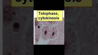 Miniature : Mémoriser la mitose facilement - PASS LAS biologie cellulaire médecine