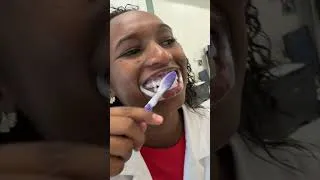 Miniature : Des dents blanches en 30 minutes seulement ? 🦷 #teethwhitening #astuce #beaute